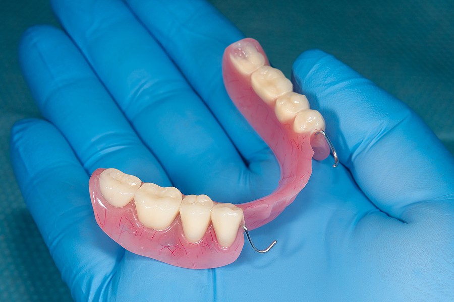 Denture and Dental Implants